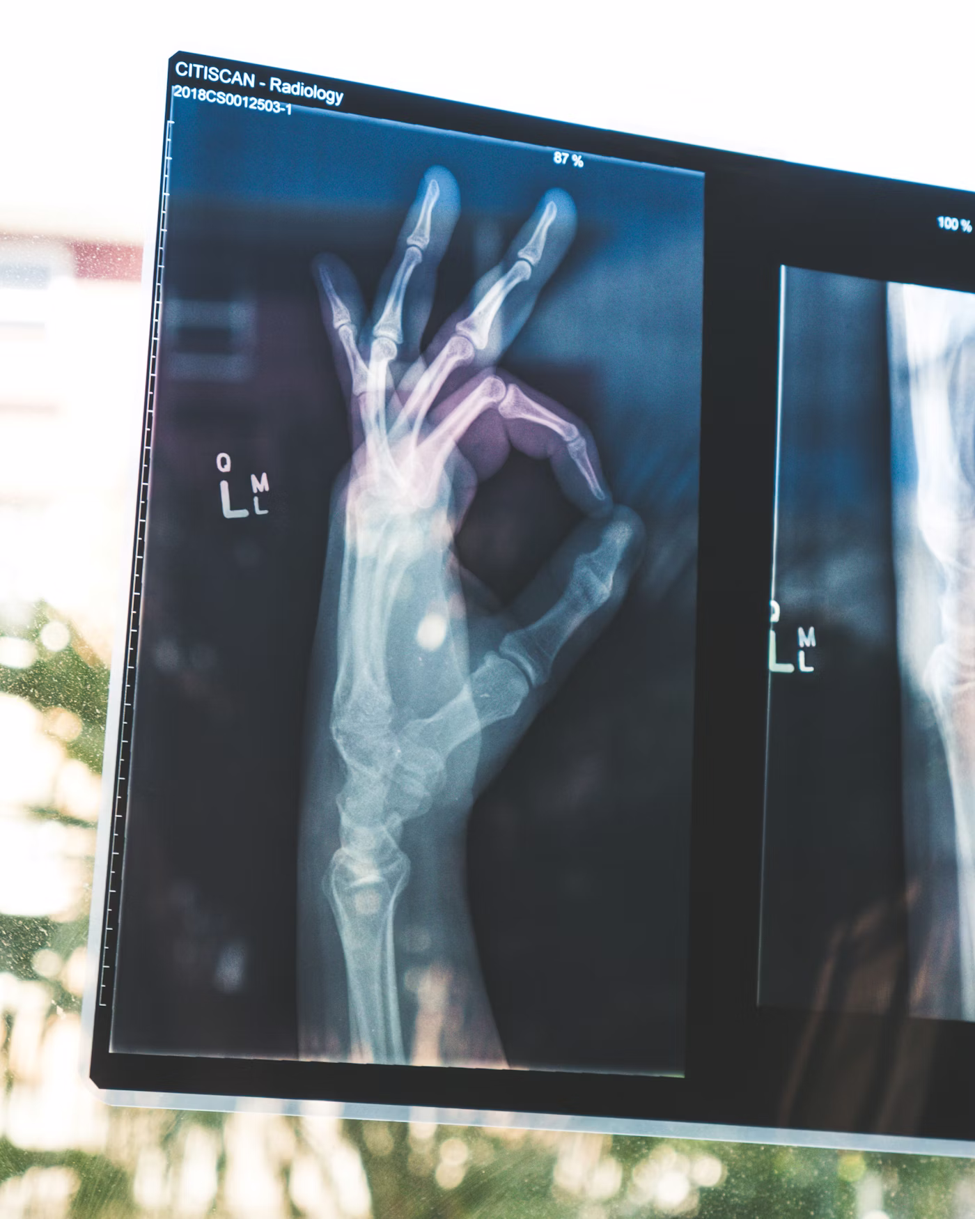 Implantable Devices